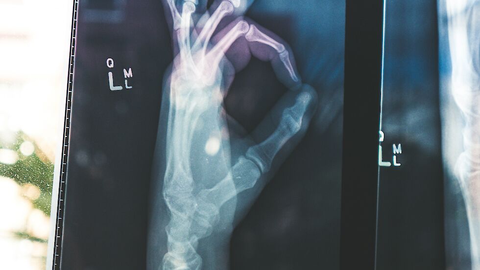 X-ray image of a human hand